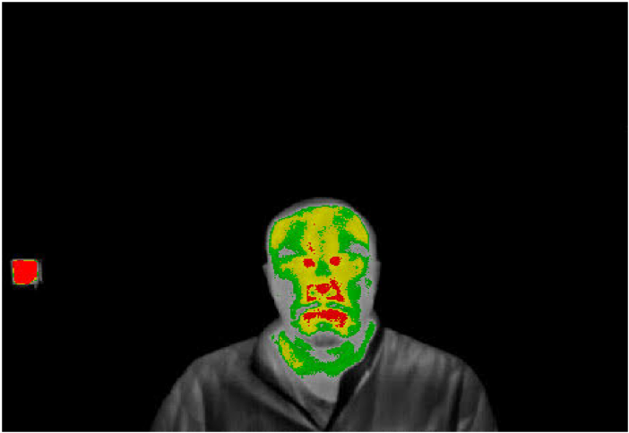 How to Evaluate Body Temperature Camera Solutions